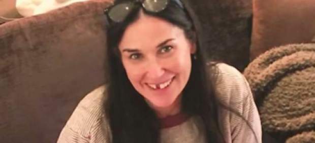 Demi-Moore-Dientes.jpg